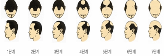 심는가발 이미지