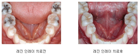 e편한치과 이미지