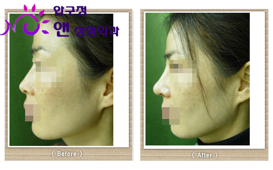 광주싸이클럽 이미지