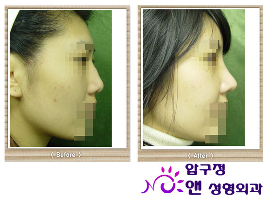 광주싸이클럽 이미지