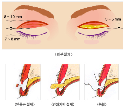 메이저성형외과 이미지