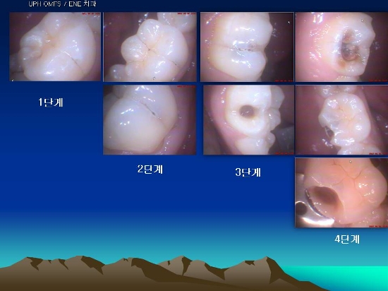 성북이엔이치과 이미지