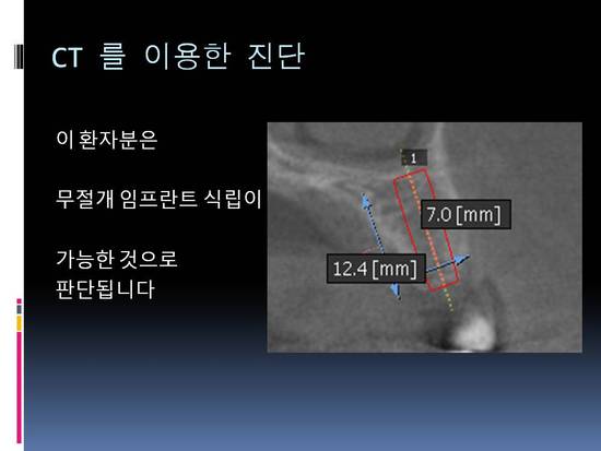 성북이엔이치과 이미지