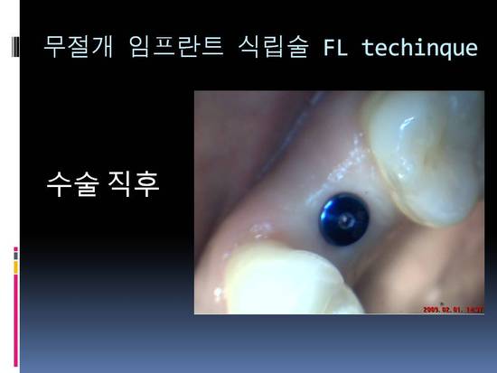 성북이엔이치과 이미지