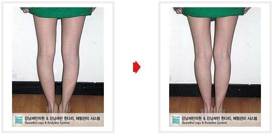 세란의원 이미지