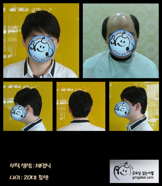 심는가발 이미지