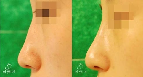파시안 이미지