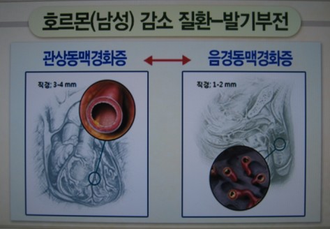 하나열쇠 이미지