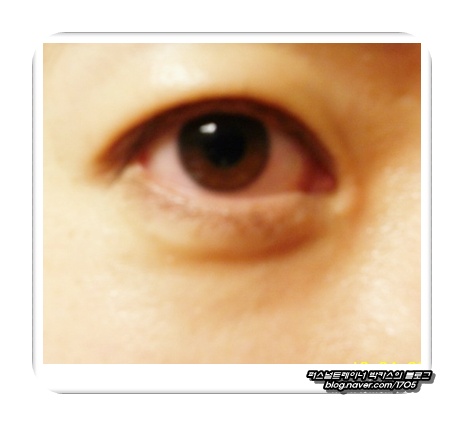 EYE이뻐 이미지