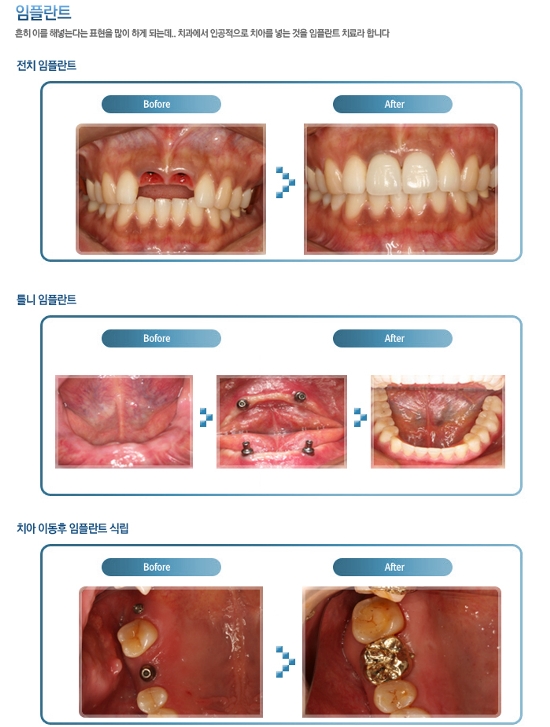 송파예치과 이미지