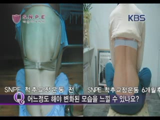 바른 척추 운동 센터 이미지