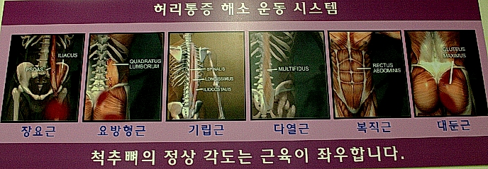 수케어시스템 이미지