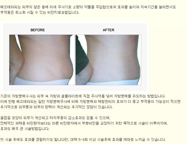 미앤미테라피 이미지