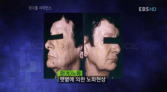 피부노화의 종류,분류, 내인성과 광노화 : 네이버 블로그