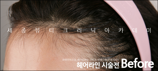 라인헤어 이미지
