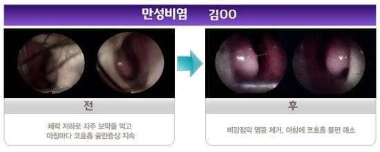 휴식공간운동요법 이미지