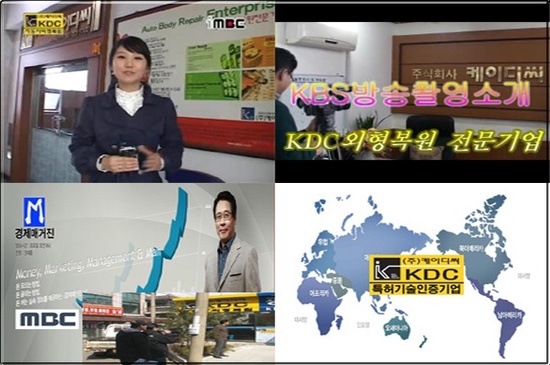케이디씨외형복원 이미지