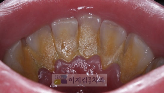 이지킴연합치과 이미지