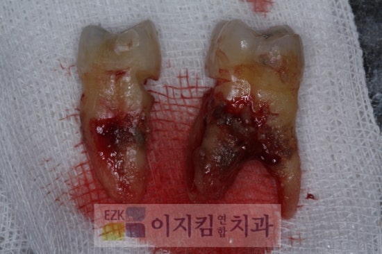 이지킴연합치과 이미지