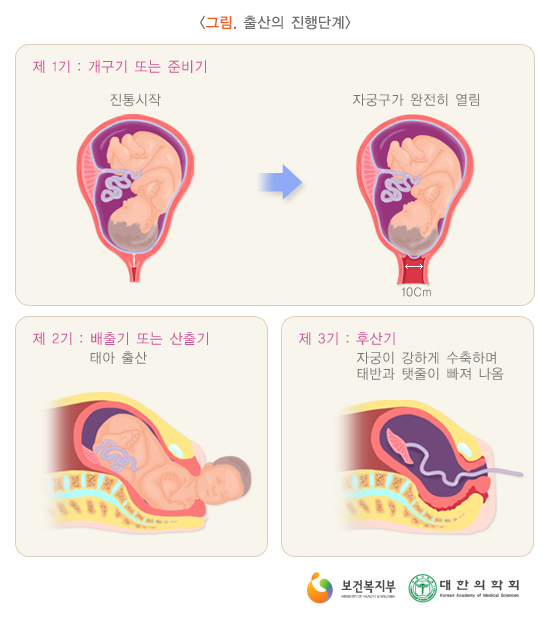 자연분만의 장점과 자연분만의 궁금증들(제왕절개와 비교) : 네이버 블로그