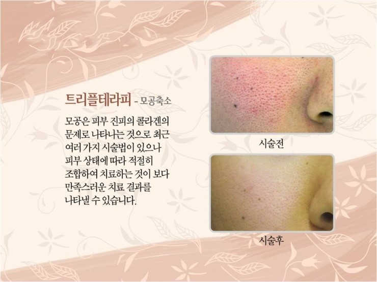 피브로한의원 이미지
