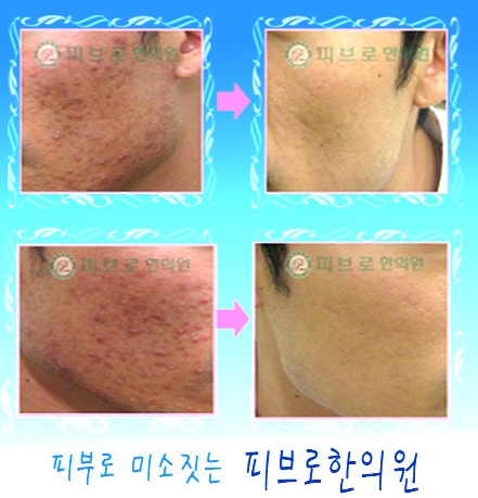 박성익한의원 이미지