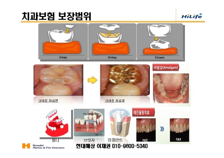 현대하이치과 이미지