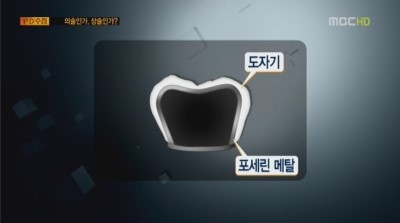 이노치과 이미지