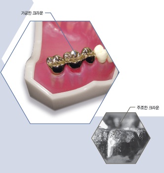 이노치과 이미지