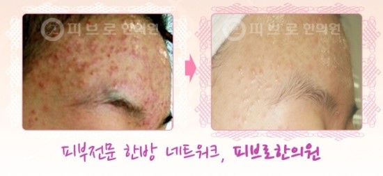 박성익한의원 이미지