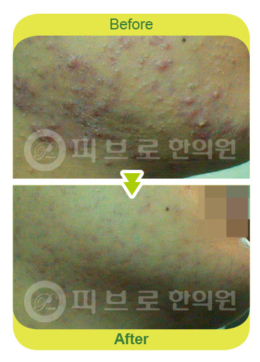박성익한의원 이미지