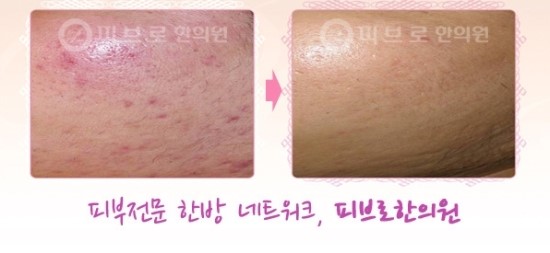 박성익한의원 이미지