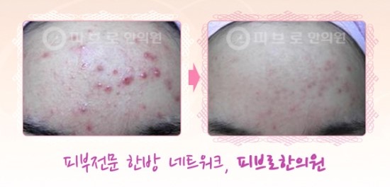 박성익한의원 이미지