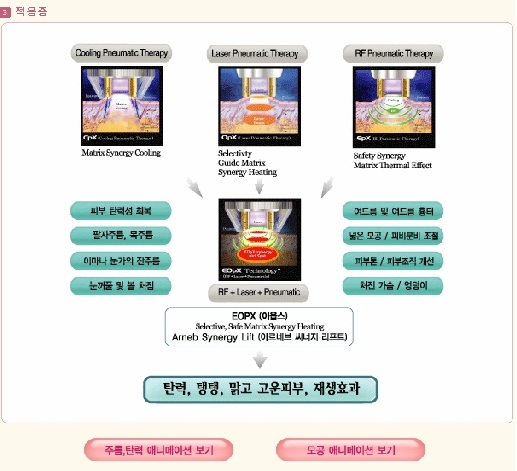 아르네브 이미지