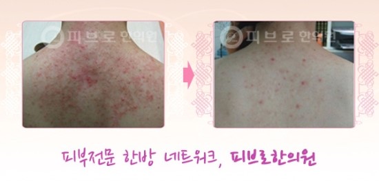 박성익한의원 이미지