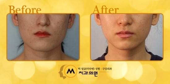 예쁜브이라인의원 이미지