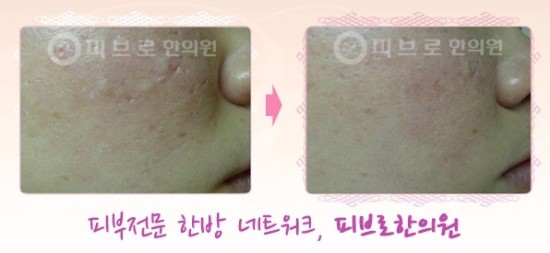 박성익한의원 이미지