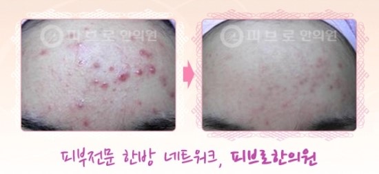 박성익한의원 이미지