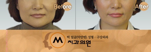 마실치과의원 이미지