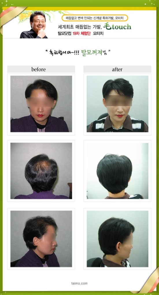 모터치 이미지
