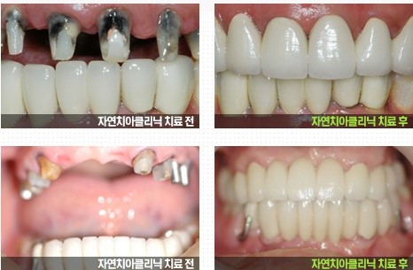 이롬치과 이미지