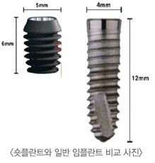 이롬치과 이미지