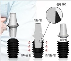 이롬치과 이미지