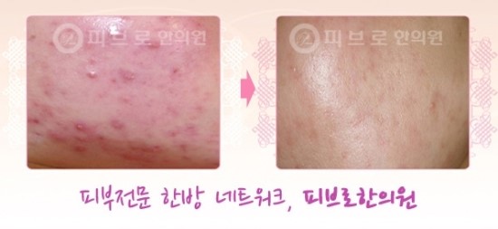 박성익한의원 이미지