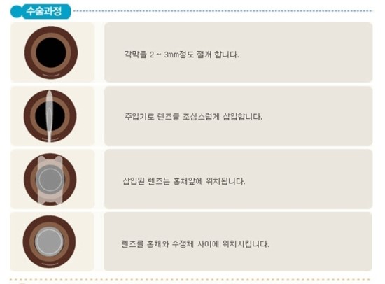 한솔안과 이미지