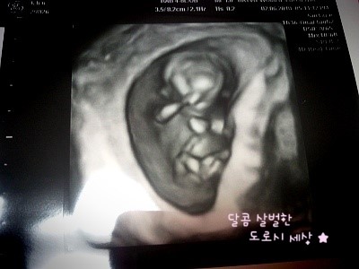 뿅이아니고뿅 이미지