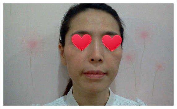 샤넬림스킨케어 이미지