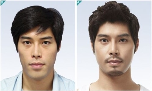 황호성형외과 이미지