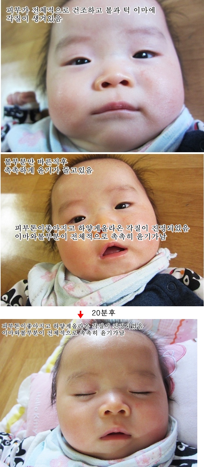 아이에이디 이미지