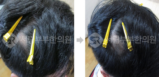 서림한의원 이미지